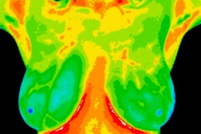 Mammogram